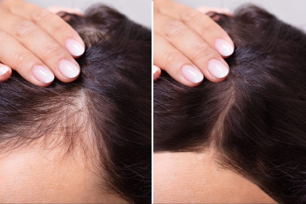 hair-loss-nyc-dr-roya